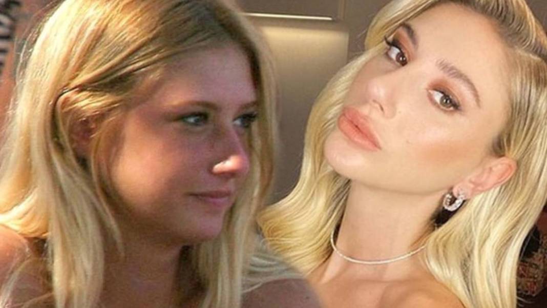 İşte estetikli ünlülerin listesi! Listeyi görünce 'yok artık onda da mı var?' diyeceksiniz 8